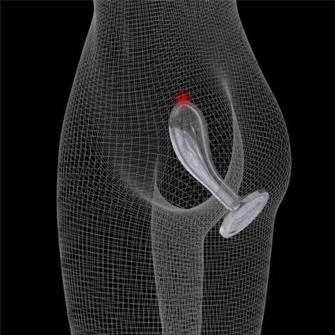Flawless Clear Prostate Plug 6.0'' Flawless Clear Prostate Plug 6.0''