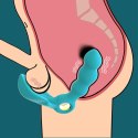 STYMULATOR-ANGELO MALE PROSTATE TRIPLE STIMULATION (BLUE)