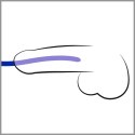 SILIKON DILATOR SET