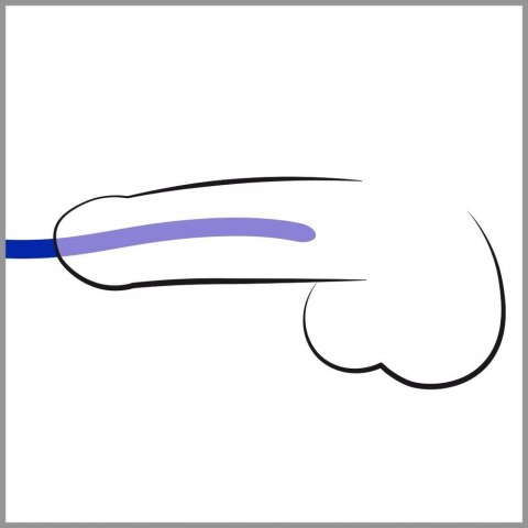 SILIKON DILATOR SET SILIKON DILATOR SET