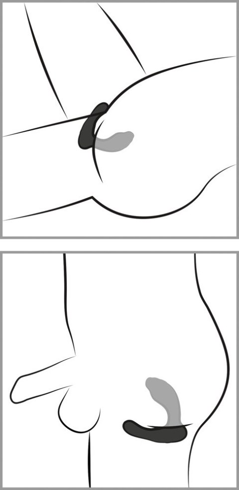 Smile RC G-&P-Spot Vibrator