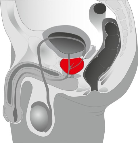 PROSTATA TWISTER PROSTATA TWISTER