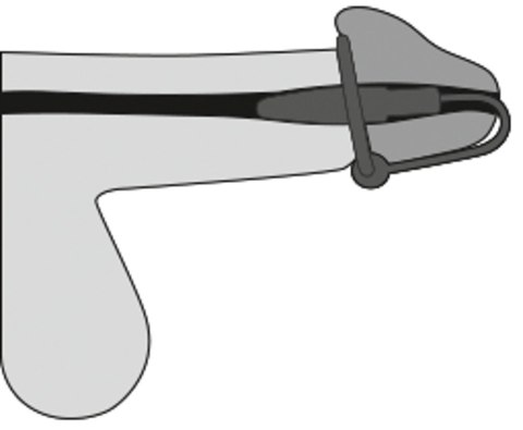 PLUG- PENISPLUG MIT SILIKO PLUG- PENISPLUG MIT SILIKO